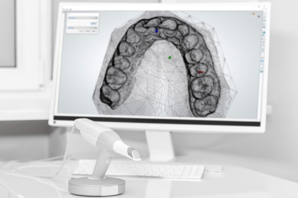 impresión 3D dentista