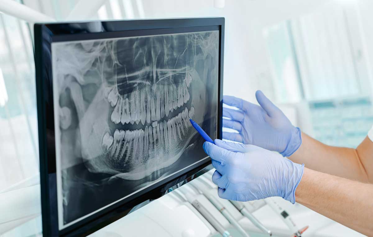 implante dental por ordenador