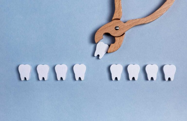 extracción dental en málaga