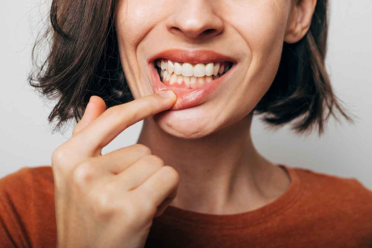 tratamiento-gingivitis-malaga